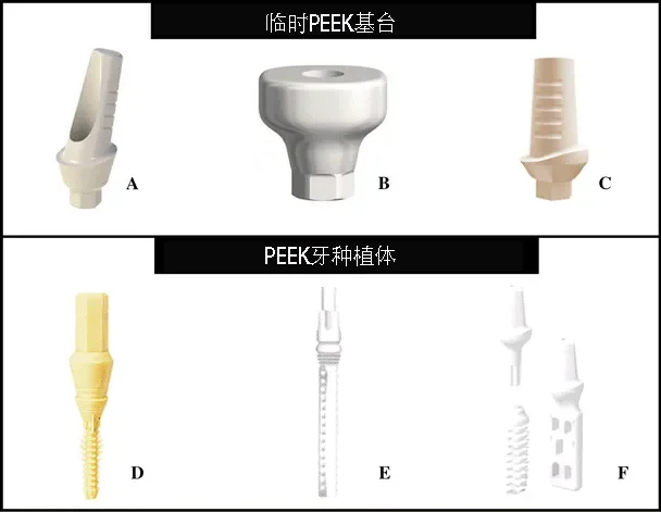 PEEK在口腔种植中的应用前景