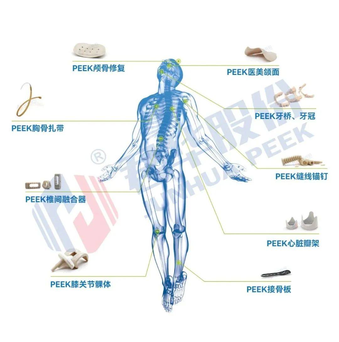 君华股份荣获江苏省科学技术奖二等奖｜“医用植入级PEEK材料关键技术研发及产业化”项目